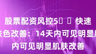 股票配资风控5️⃣快速见效的肤色改善：14天内可见明显肌肤改善